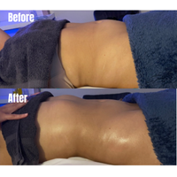 Lymphatic Drainage Drops