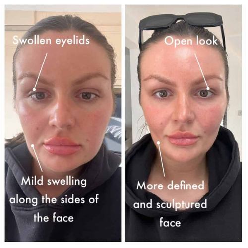 Lymphatic Drainage Drops